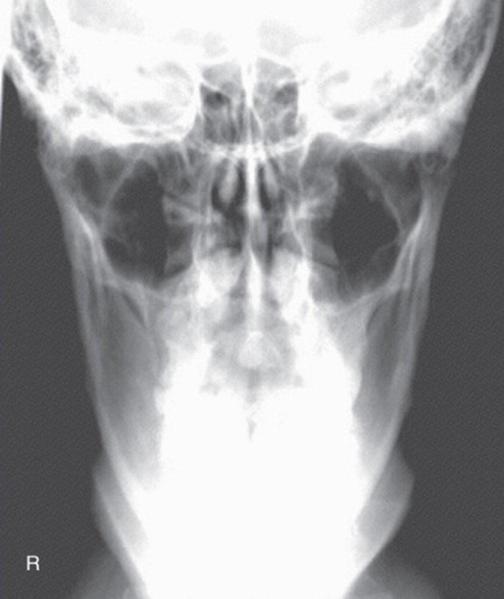 <p>What position/projection?</p>