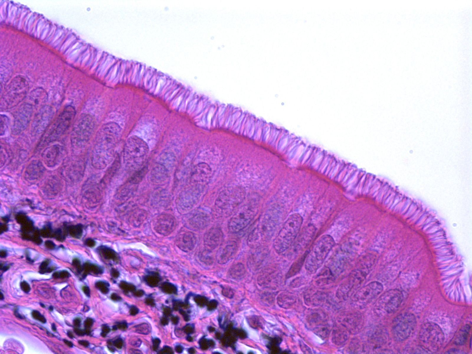 <p>a type of epithelium that appears to be stratified but instead consists of a single layer of irregularly shaped and differently sized columnar cells</p>