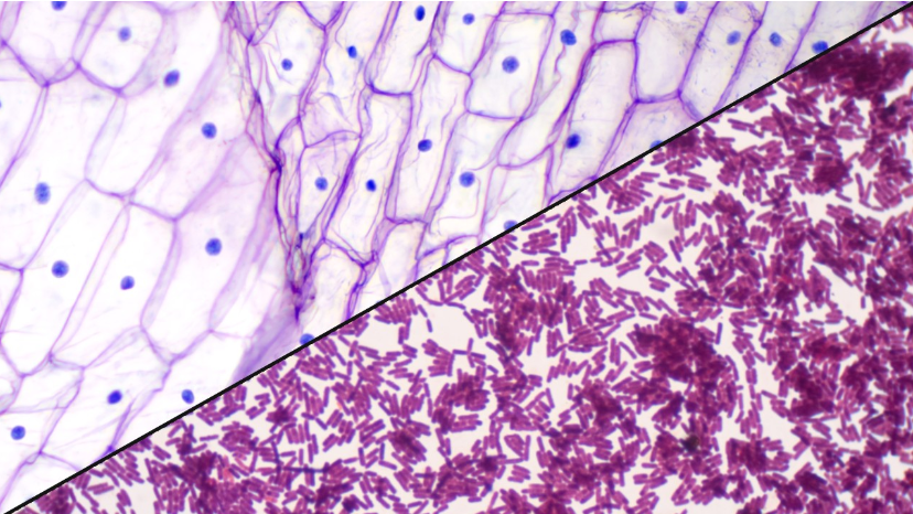 <p>Prokaryotic vs. Eukaryotic cells</p>