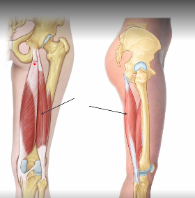 <p>Biceps femoris long head</p>