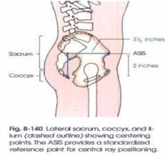 <p>LATERAL PROJECTION</p>