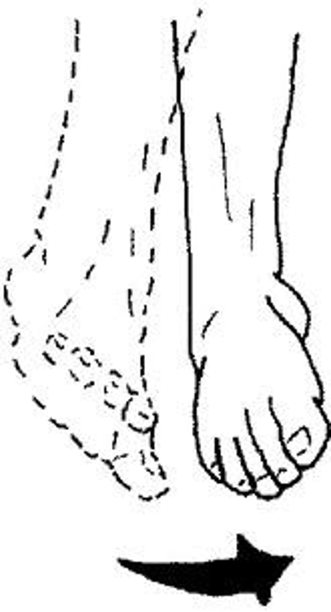 <p>Turning the sole of the foot medially (inward).</p>