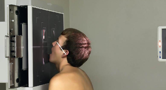 <ul><li><p>patient position:</p><ul><li><p>upright</p></li><li><p>MSP centered to midline</p></li></ul></li><li><p>part position:</p><ul><li><p>rest chin on IR</p></li><li><p>hyperextend neck to place OML at 37 degree angle from IR</p></li><li><p>MSP perpendicular to IR</p></li><li><p>open mouth</p></li></ul></li><li><p>respiration suspended</p></li><li><p>CR:</p><ul><li><p>horizontal, exits acanthion</p></li></ul></li><li><p>collimation:</p><ul><li><p>1 inch beyond the lateral skin shadows, superiorly to include just the shadow of the top of the head, and inferiorly to the occlusal plane </p></li></ul></li></ul><p></p>