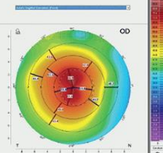 <p>smaller more centralized moutnain</p>