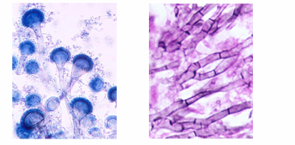 <p>-infection caused by the genus Aspergillus (A. fumigatus is most common species)</p><p>-ubiquitous worldwide, especially in decomposing material</p><p>-humans inhale millions of spores per day</p><p>-immunity: macrophages are primary defense</p><p>-mold → hyphae are narrow and septate, branching at 45 degrees</p>