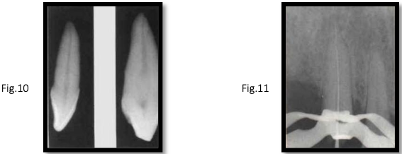 <p>canal anatomy of <strong>mx canine</strong></p>
