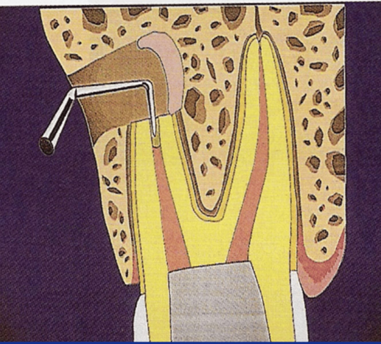 <p>ID the surgical procedure:</p>