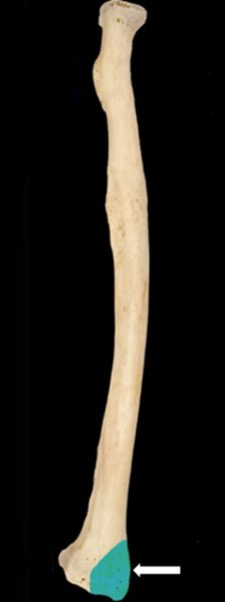 <p>name the part</p>