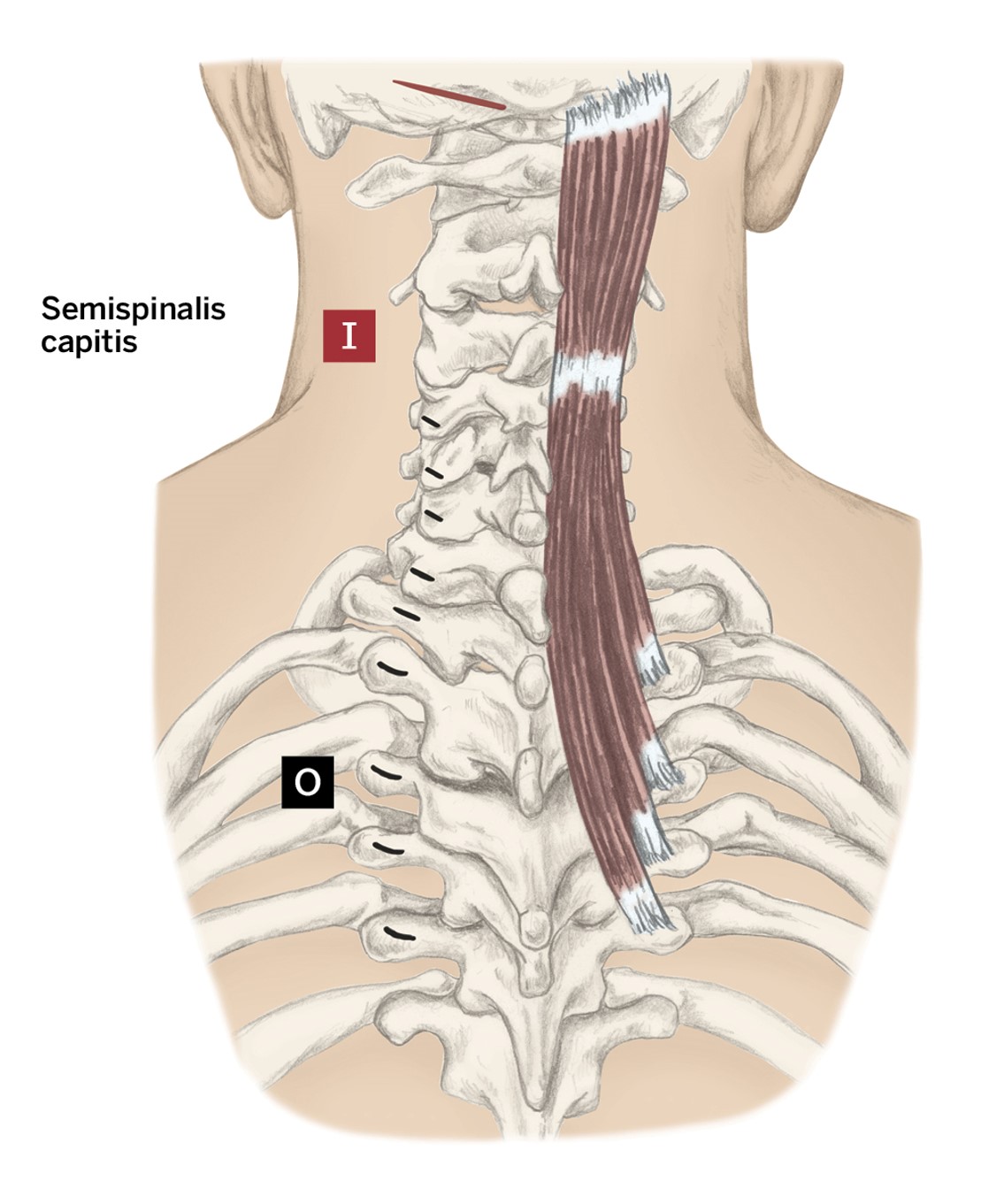 <p>O- Lower cervical and upper thoracic vertebrae: Transverse processes</p><p>I- Occiput</p><p>A- Vertebrae extension and contralateral rotation</p>