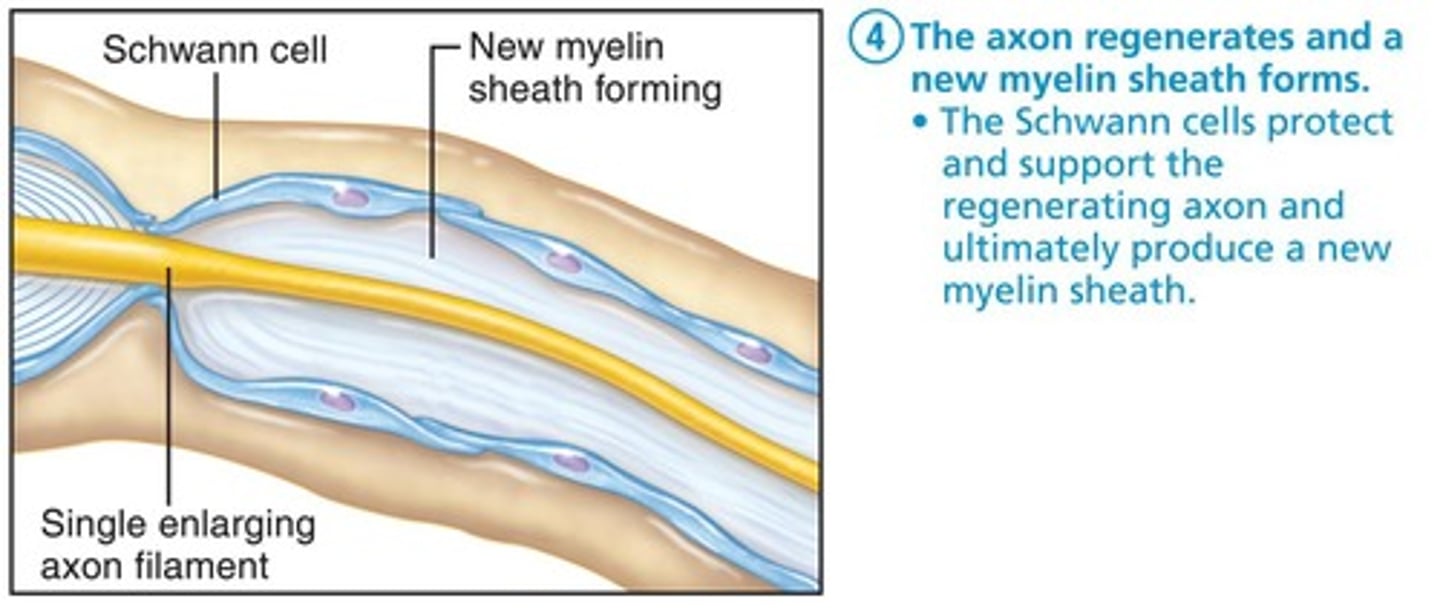 <p>forms after axon regenerates</p>
