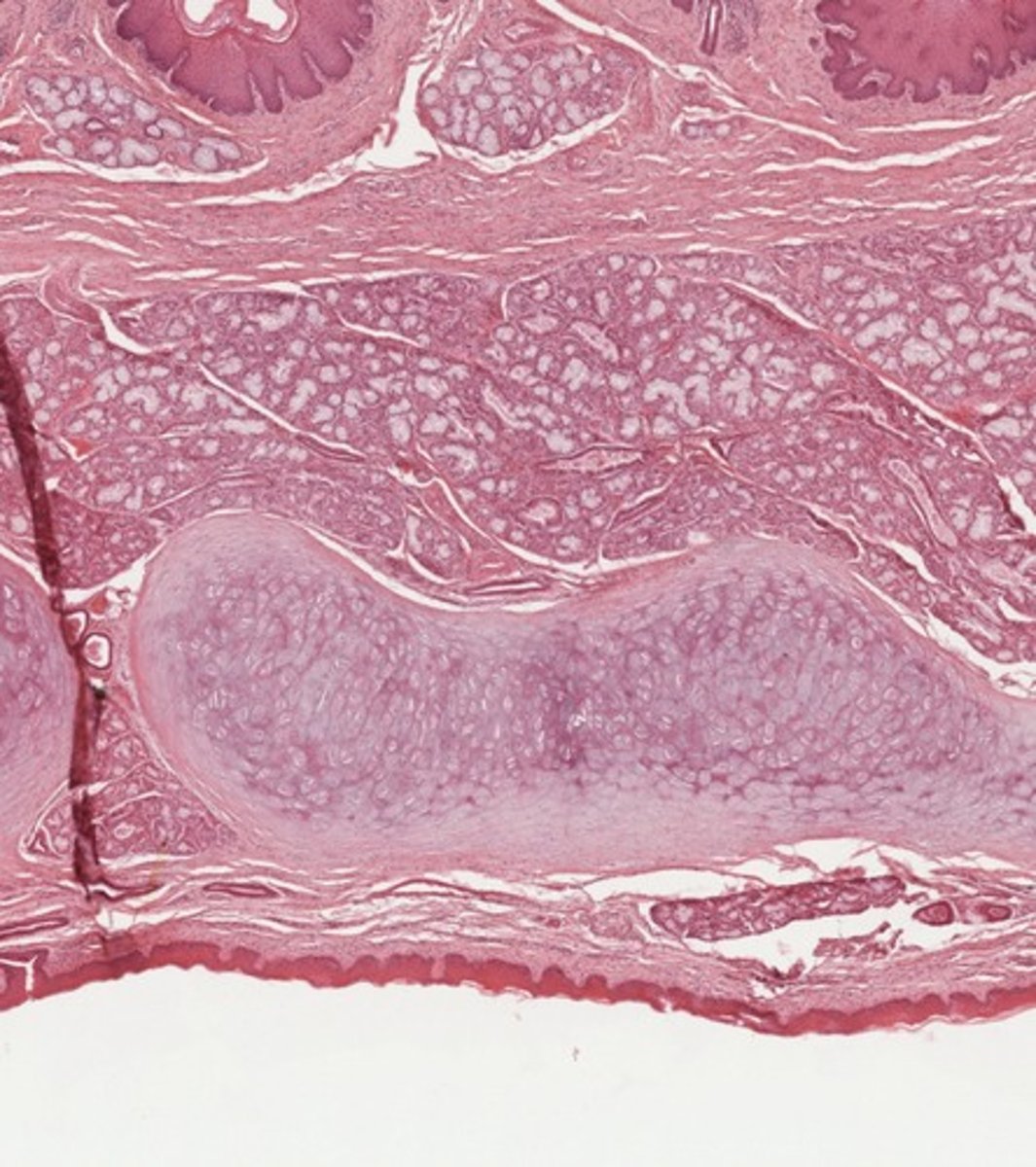 <p>What cartilage type is depicted here?</p>