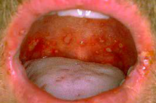 <p><span style="color: blue;"><strong><em><u>SPECIFIC INFECTIONS</u></em></strong></span></p><p>Gonorrhea (oral)</p><ul><li><p>Clinical Signs</p></li><li><p>Etiology</p></li><li><p>Treatment</p></li></ul><p></p>