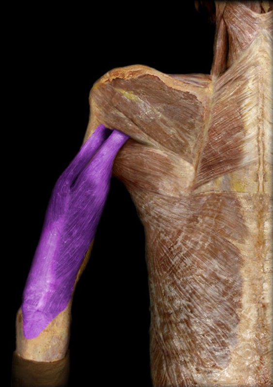 <p>Name the muscle highlighted (two words - all lowercase)</p>