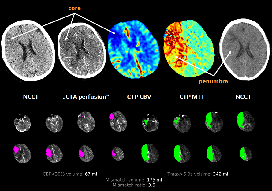 <p>What type of scan is CT Perfusion considered?</p>