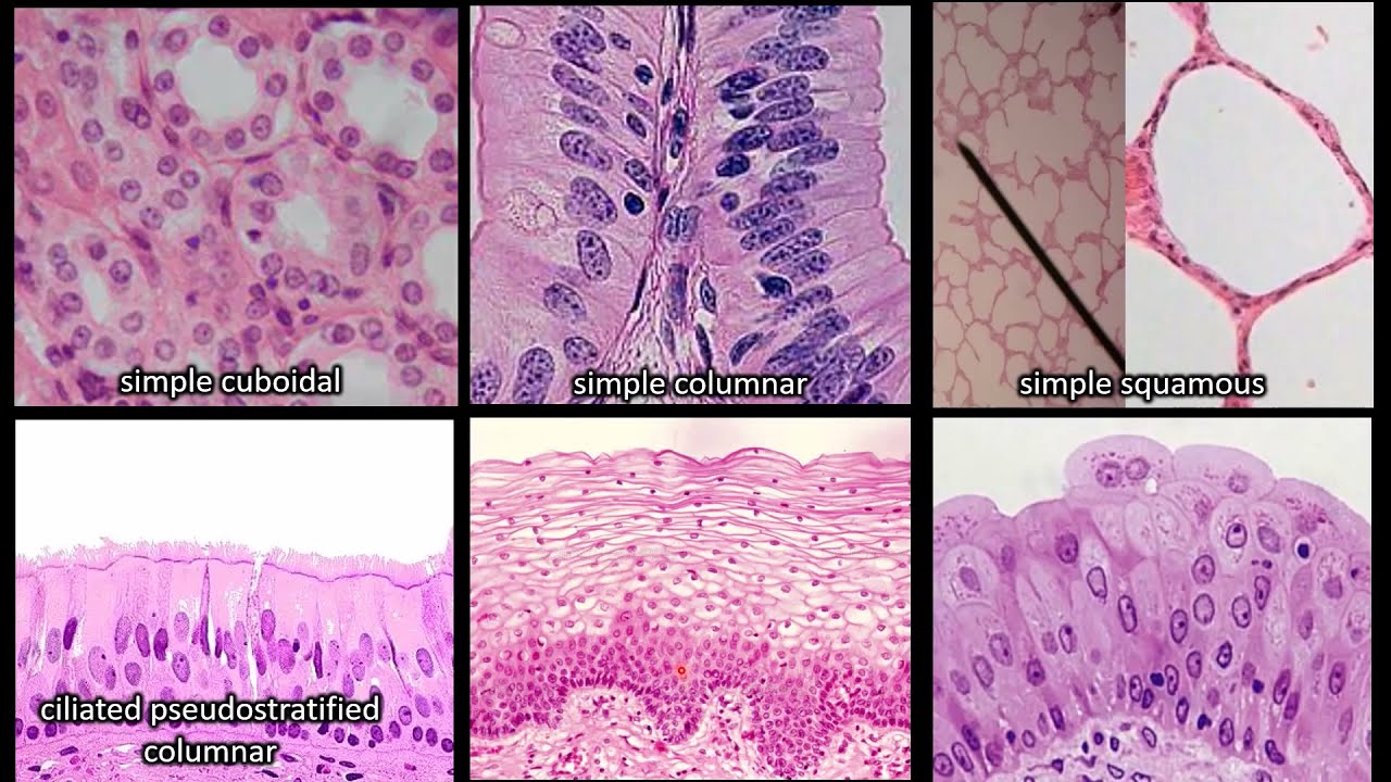 epithelial