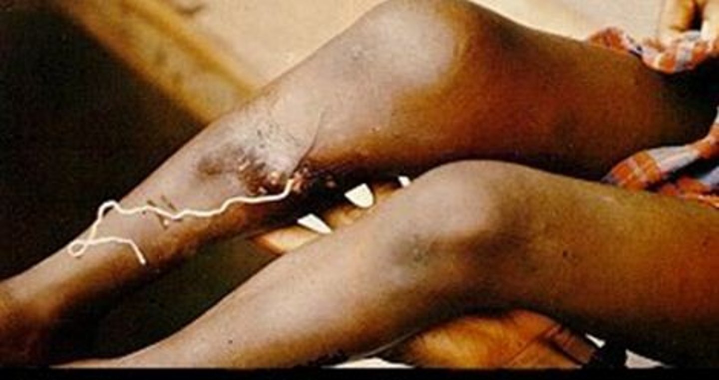 <p>Any kind of living thing that lives on or in another living thing. It gets its food from inside the other living thing. It sometimes hurts the other living thing.</p>