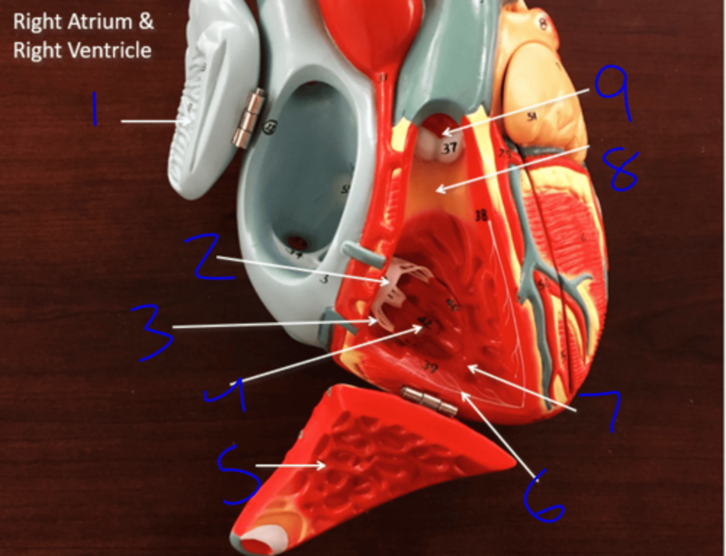 <p>Right Ventricle - #5</p>