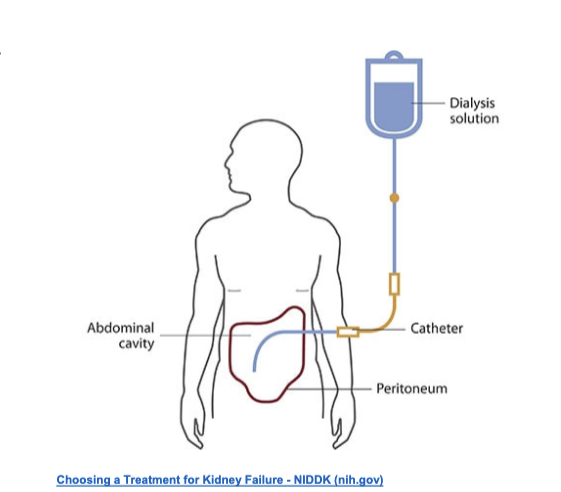 <ul><li><p>type of dialysis that uses the <strong>peritoneum in a person’s abdomen as the membrane</strong> through which fluid and dissolve substances are exchanged with the blood</p></li><li><p>to remove excess fluid, correct electrolyte problems, and remove toxins in those with kidney failure</p></li></ul><p></p>
