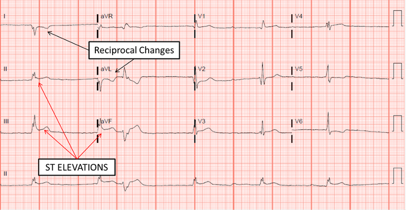 <p>Reciprocal changes </p>