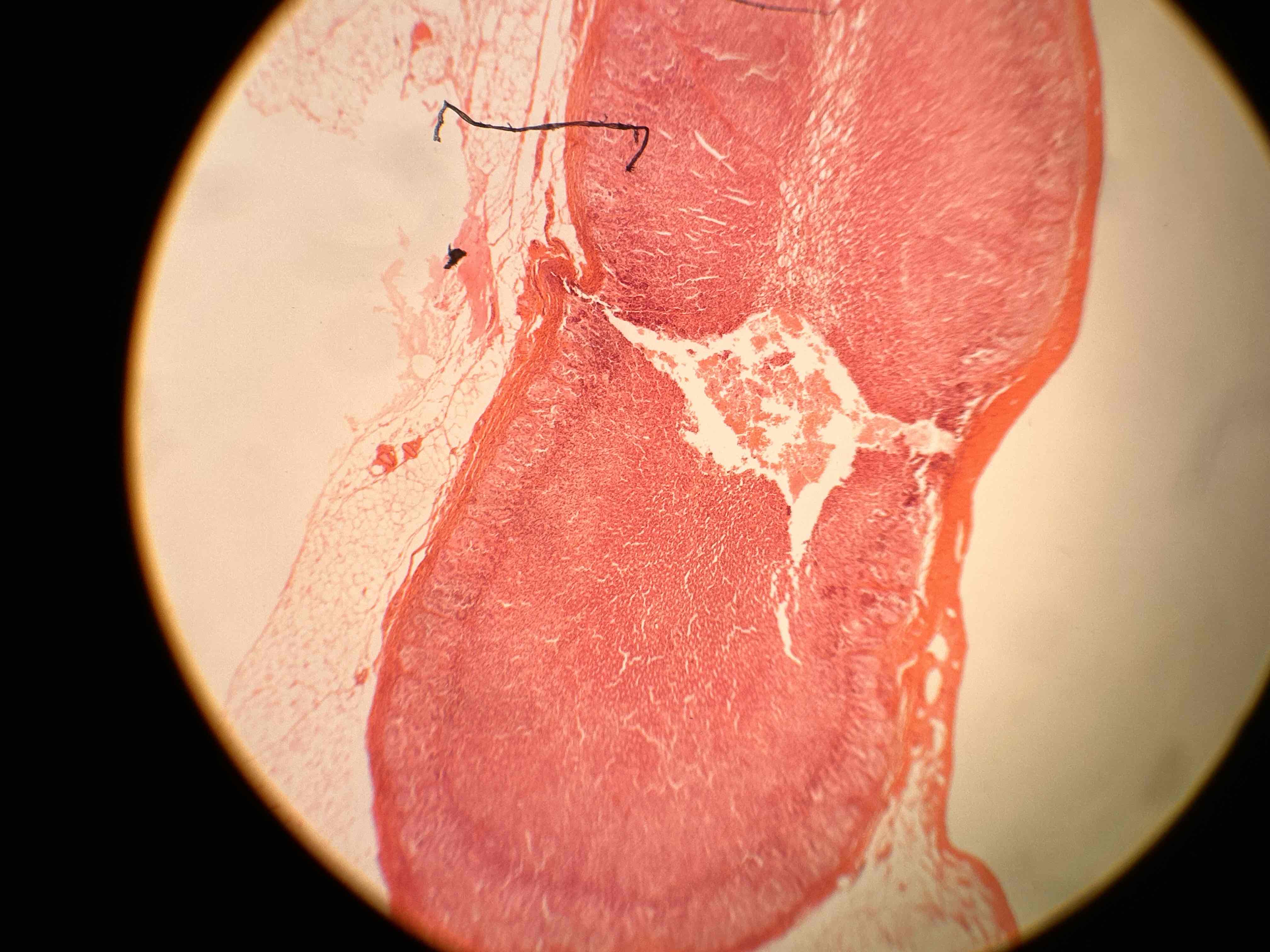 term image