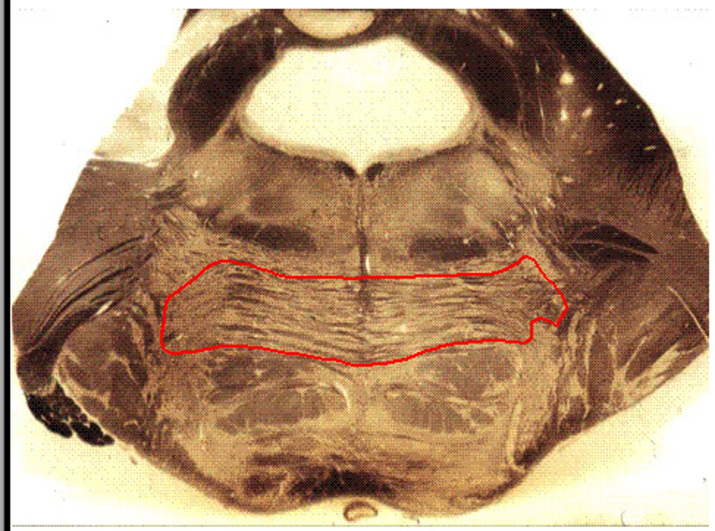 <p>also called pontocerebellar fibers</p>