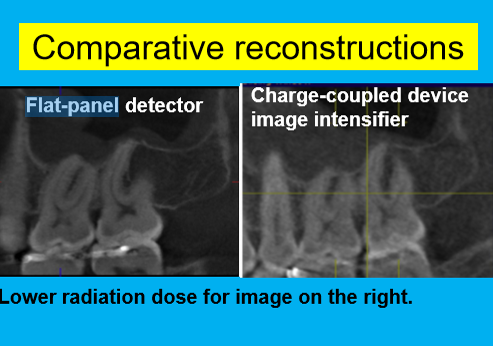 <p>flat panel detector</p>