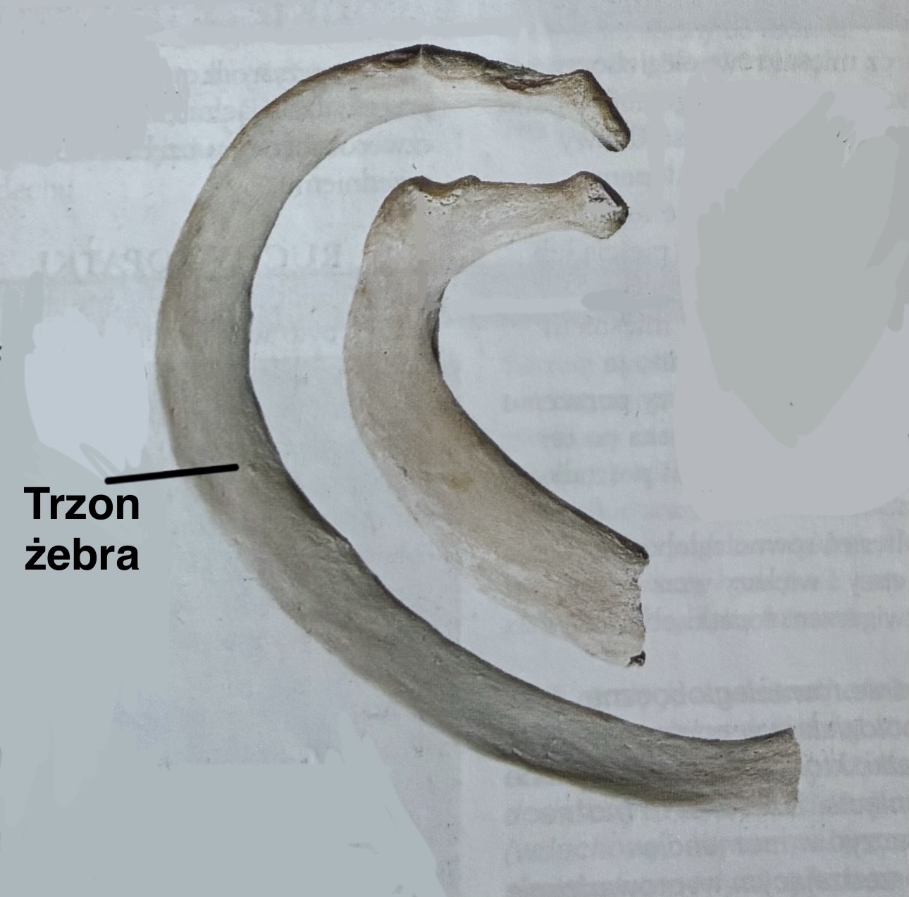 <p>Trzon żebra</p><p>(z opisem)</p>