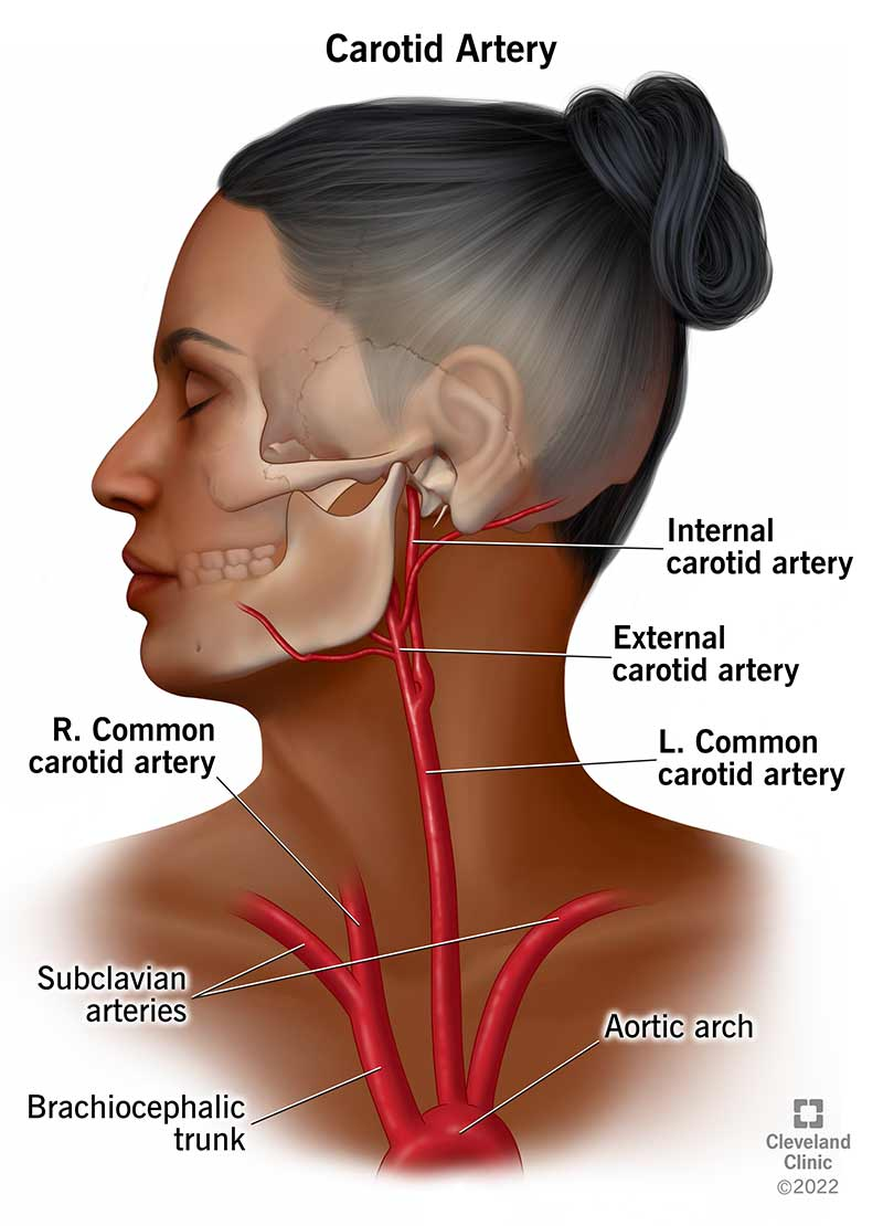 <p>Origin: Right branches from <mark data-color="yellow">brachiocephalic trunk</mark> and left branches from <mark data-color="yellow">aortic arch</mark></p><p>Terminates: Superior border of thyroid cartilage and internal &amp; external carotid</p><p>Contains: <mark data-color="blue">Carotid bodies</mark>, <mark data-color="yellow">innervated by CNIX (glossopharyngeal)</mark></p>