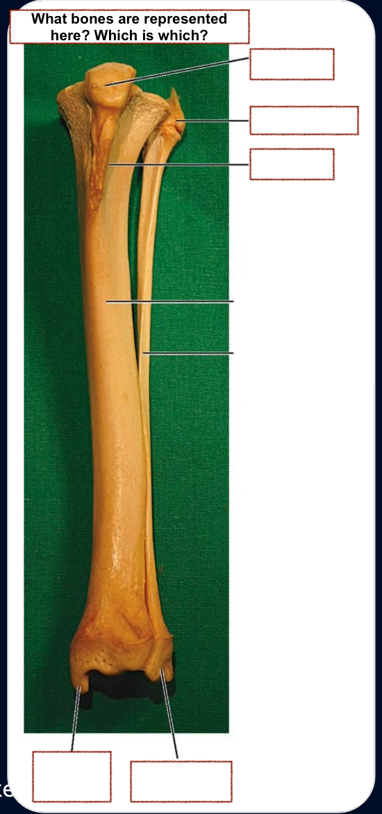 <p>Head of fibula</p><p>Tibial crest</p><p>Patella</p><p>Shaft of tibia/fibula</p><p>Lateral malleolus</p><p>Medium malleolus</p>