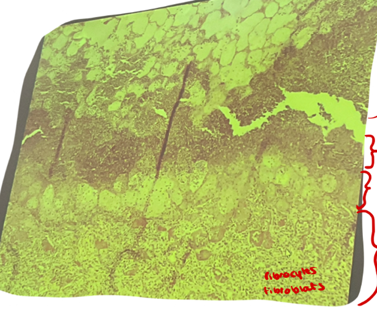 <p>this is?</p><img src="https://knowt-user-attachments.s3.amazonaws.com/fe93eb30-3f19-4bb6-8797-2a23e44bfe53.png" data-width="100%" data-align="center"><p></p>