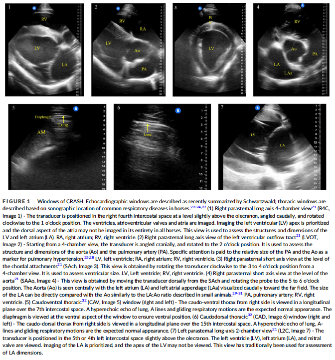 <p>Objective: a. Describe the windows of a POCUS protocol for cardiorespiratory assessment of horses (CRASH) b. Estimate the number of acoustic windows that can be acquired by a sonographer in training c. Estimate the time required to complete the protocol for specific groups of horses d. Describe the sonographic abnormalities detected in horses presented with cardiovascular, respiratory, or systemic disease</p><p>Results:</p><ul><li><p>The CRASH protocol could be performed in healthy and diseased horses in hospital, barn, and competition settings between 5.5 min (athletic horses) and 6.9 min (horses with clinical disease)</p></li><li><p>Thoracic windows were obtained most consistently, followed by right parasternal long-axis echocardiographic windows</p></li><li><p>For the cardiac windows, the 4-chamber long axis window was most consistently of good quality (92.5%) and the short axis at the level of the aorta had the lowest percentage of acceptable quality images in the normal (74.1%) and hospitalized (60%) groups</p></li><li><p>For the athletic horses, the short axis at the level of the chordal attachments had the lowest percentage of acceptable quality images (78.7%) and the 2 chamber long axis window was most consistently of acceptable quality</p></li><li><p>Frequently detected abnormalities were pleural fluid, lung consolidation, B-lines, and moderate-to-severe left-sided heart disease</p></li></ul><p>Conclusion: The CRASH protocol was feasible using a pocket-sized ultrasound device in various groups of horses, could be completed rapidly in a variety of settings, and frequently identified sonographic abnormalities when evaluated by an expert sonographer. The diagnostic accuracy, observer agreement, and utility of the CRASH protocol merit further evaluation</p>