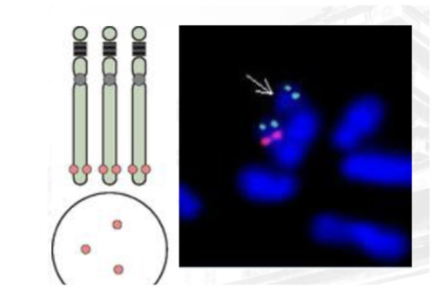 <p>Designed to cover any 2 genes for the detection of any aberrations.</p><p>Allows simultaneous detection of numerical abnormalities of two to three regions in one FISH assay</p>
