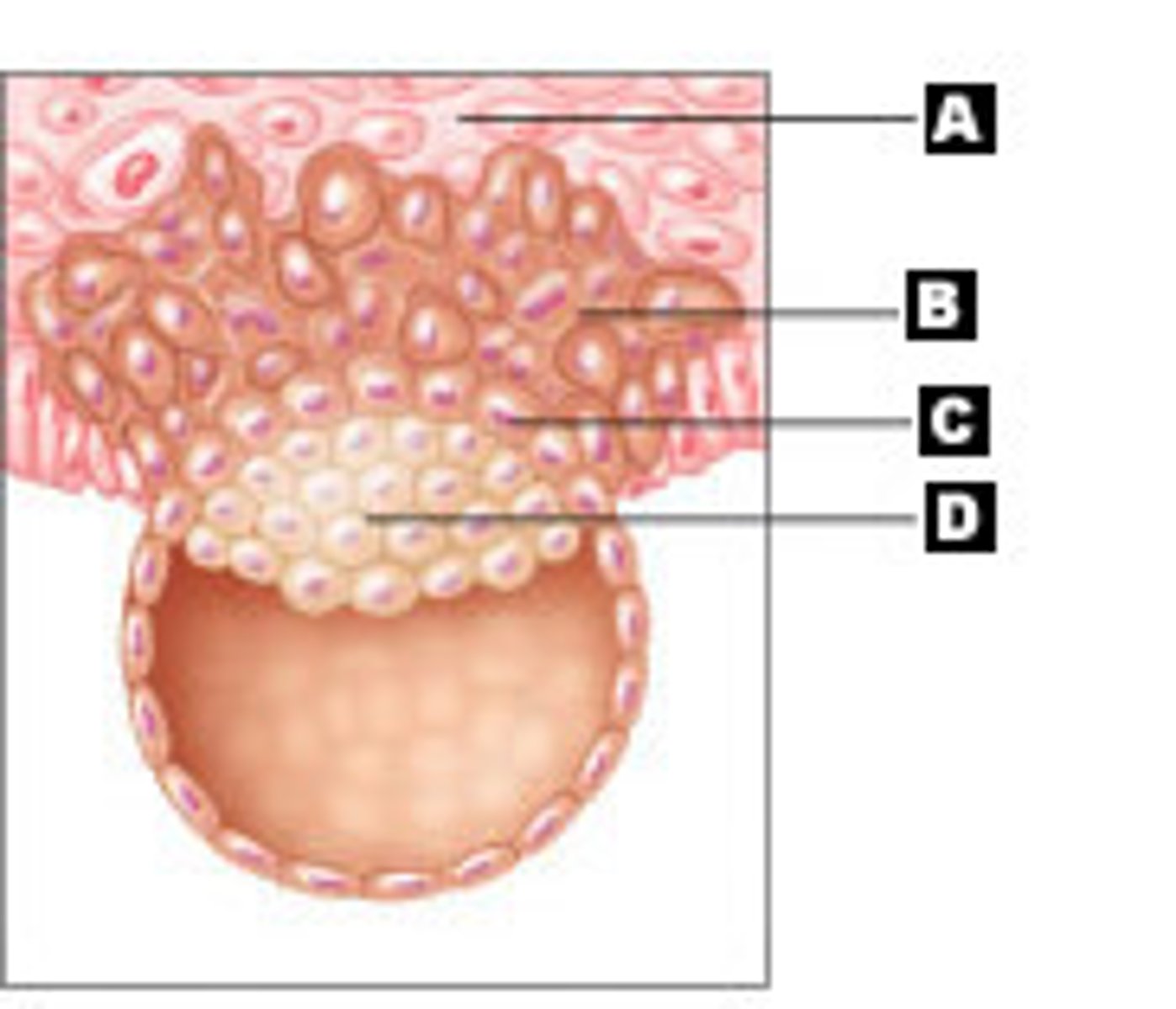 <p>A</p>