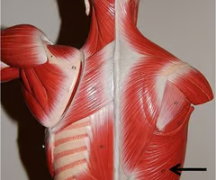 <p>What muscle is this? What is an origin? What is an insertion? What is an action?</p>