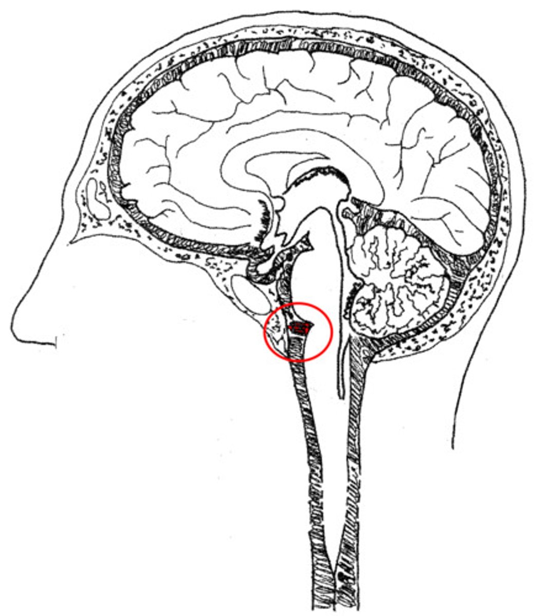 <p>cistern anterior to the pons</p>