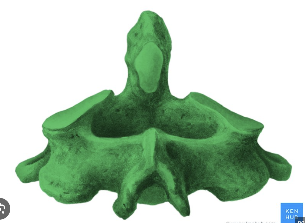 <p>Which vertebrae is this?</p>