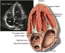 <p>What does the Apical 4 Chamber view show?</p>