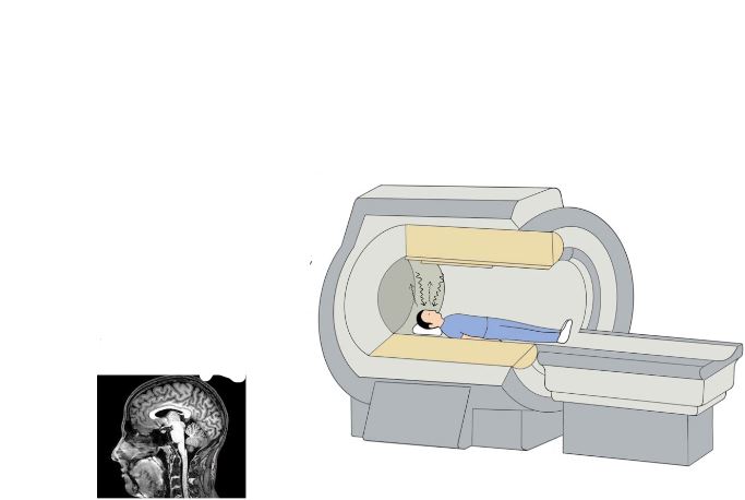 <p>(functional magnetic resonance imaging) <mark data-color="yellow">measures blood oxygen levels to see </mark><strong><em><mark data-color="yellow">where</mark></em></strong><mark data-color="yellow"> brain functions are being performed</mark></p><ul><li><p><em><span style="font-family: Arial, sans-serif">doesn’t tell:</span></em></p><ul><li><p><em><span style="font-family: Arial, sans-serif"><mark data-color="red">if the brain regions are necessary</mark></span></em></p></li><li><p><em><span style="font-family: Arial, sans-serif"><mark data-color="red">anything about cognitive processes</mark></span></em></p></li><li><p><em><span style="font-family: Arial, sans-serif"><mark data-color="red">how the brain supports cognitive processes</mark></span></em></p></li></ul></li></ul>