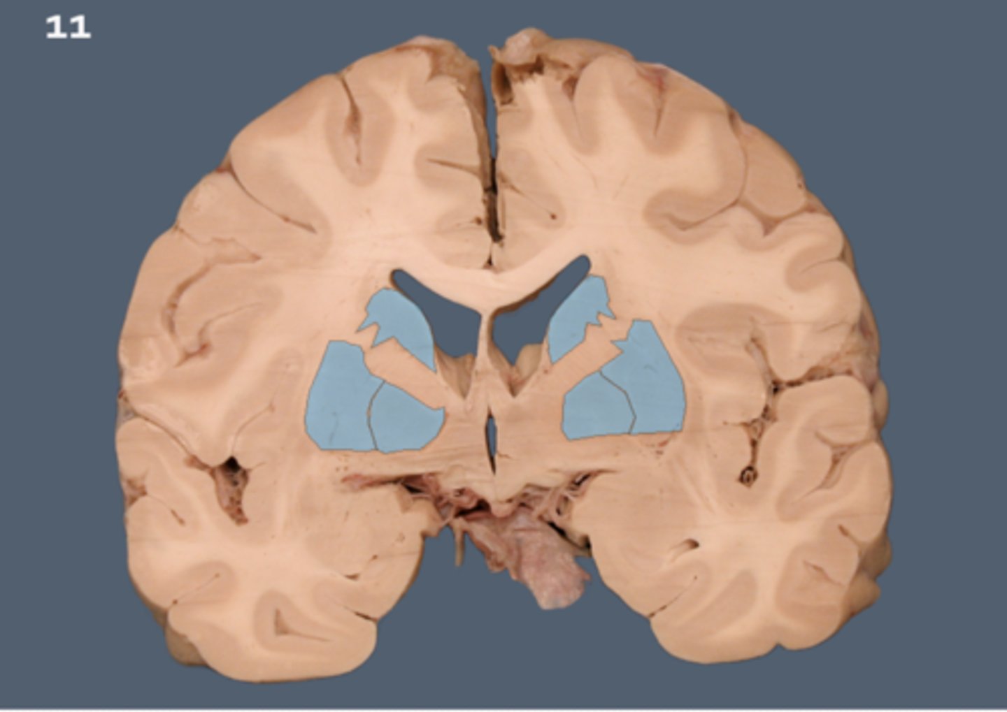 <p>structures in the forebrain that help to control movement. Composed of three main parts: the caudate nucleus, the putamen, and the globus pallidus</p>