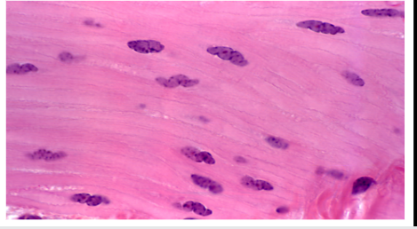 <p>stretched no space in between**</p><p>more nuclei *</p>