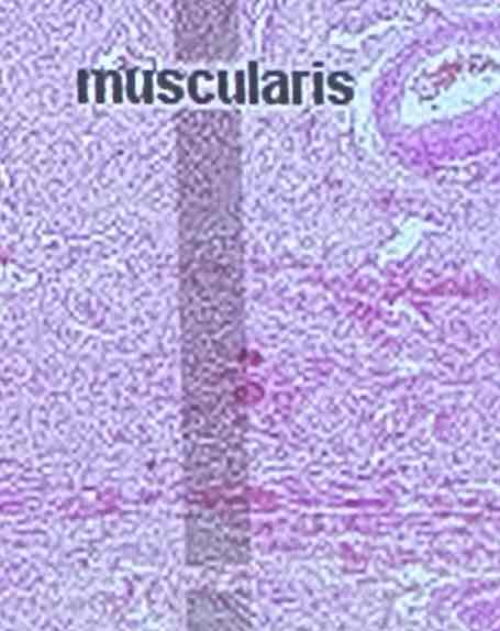 <p>smooth muscle</p>