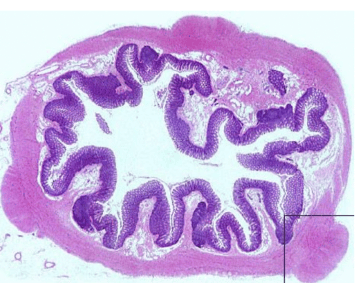 <p>tubular or parenchymal?</p>