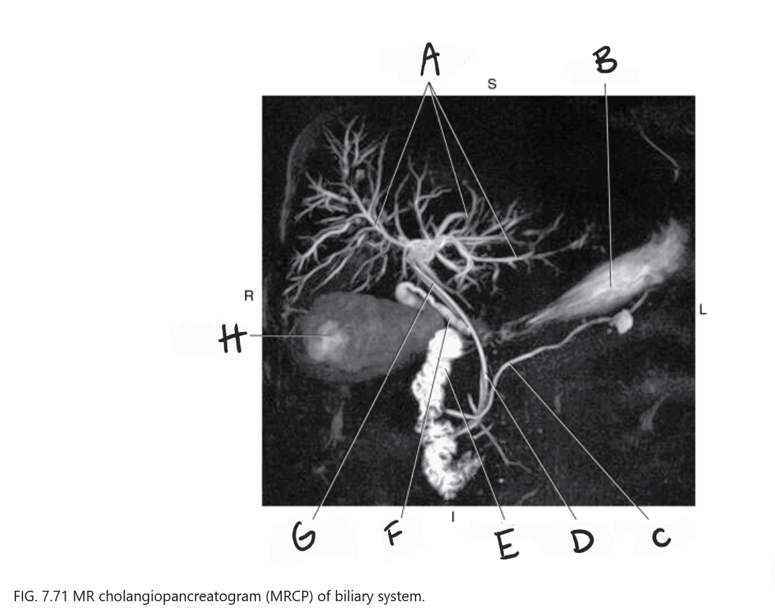 <p>What is E</p>