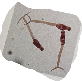 <p>What is the developmental stage in the picture? Which parasites? (Indicate genus name)</p>