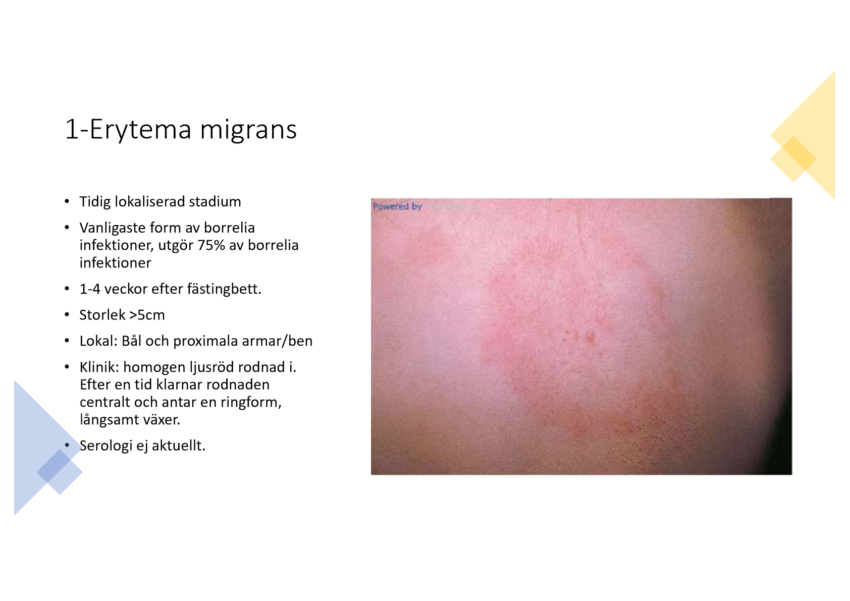 <p>Nej, oftast inte. Ingen feber och allmänpåverkan, det är en lokal infektion. </p>
