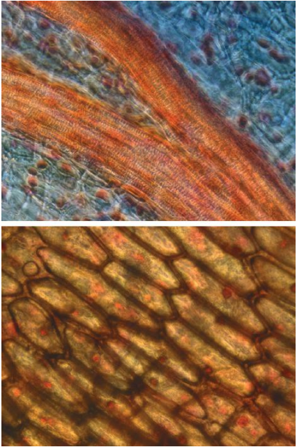 Scallion vascular tissue (top) and dermal tissue (bottom). (© Richard C. Li.)
