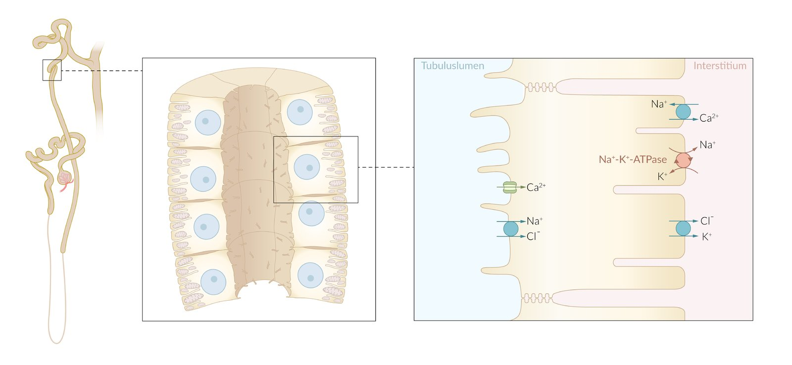 <p>A. Increased expression of TRPV5 channels</p>
