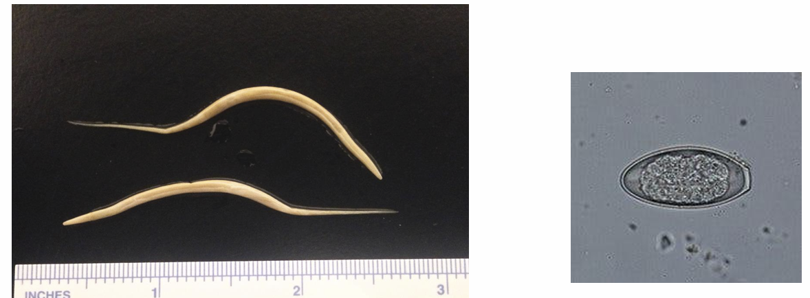 <p>Oxyuroidea (pinworms) </p>