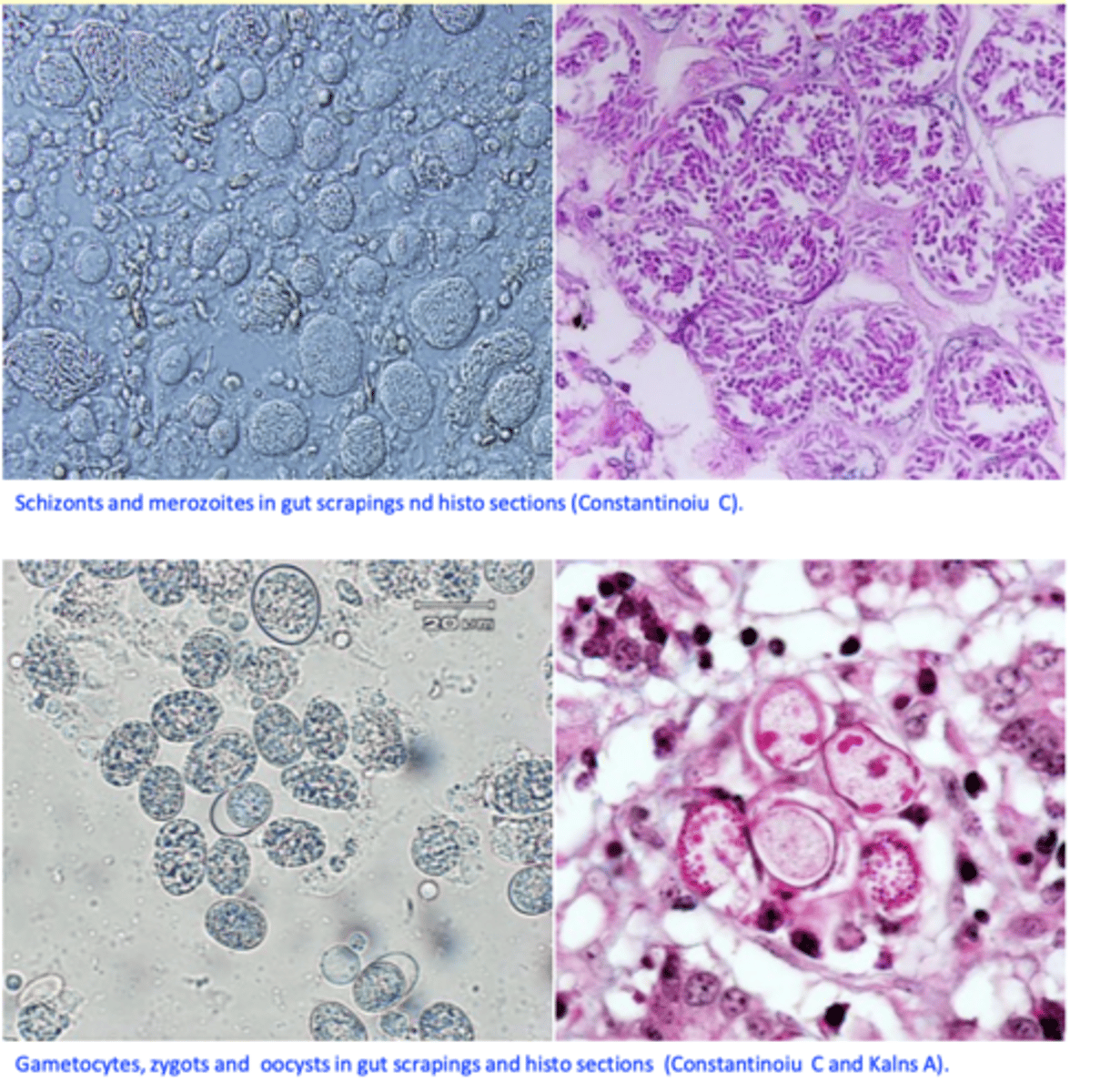 <p>Pathology</p><p>• Identification of the parasites:</p><p>• Schizonts, merozoites, gametocytes, oocysts in gut scrapings or histological sections;</p>