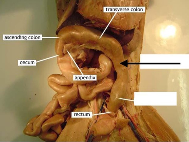 <p>What portion of the large intestine is indicated by the black arrow?</p>